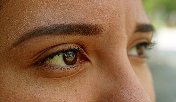 Hay una enfernmedad contagiosa que ya causa preocupación a las autoridades de